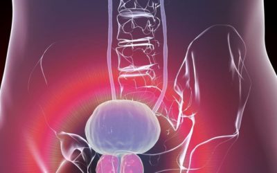 Cancer de la prostate : quels sont les bons réflexes à avoir ?